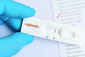 legionella test in water from a healthcare building in new york city