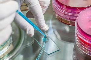 Specimen examination for Legionella test in a laboratory