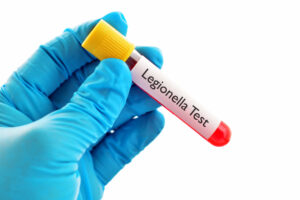 hand covered with latex glove holds a test tube with a label called legionella test
