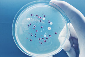 lab technician holds petri dish that might contain legionella bacteria