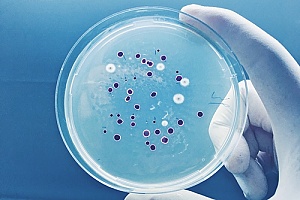 Legionella culture in petri dish