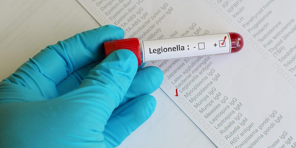 Blood sample that has tested positive for Legionella