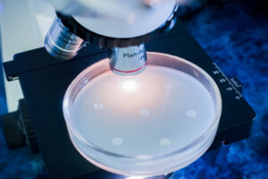 petri dish containing collected sample is put under the microscope to check for legionella