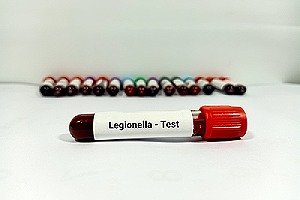 Test tube with blood sample for Legionella test