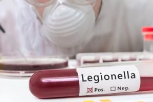 Legionella Return Samples to a Lab