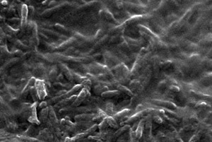 Legionella Under Microscope