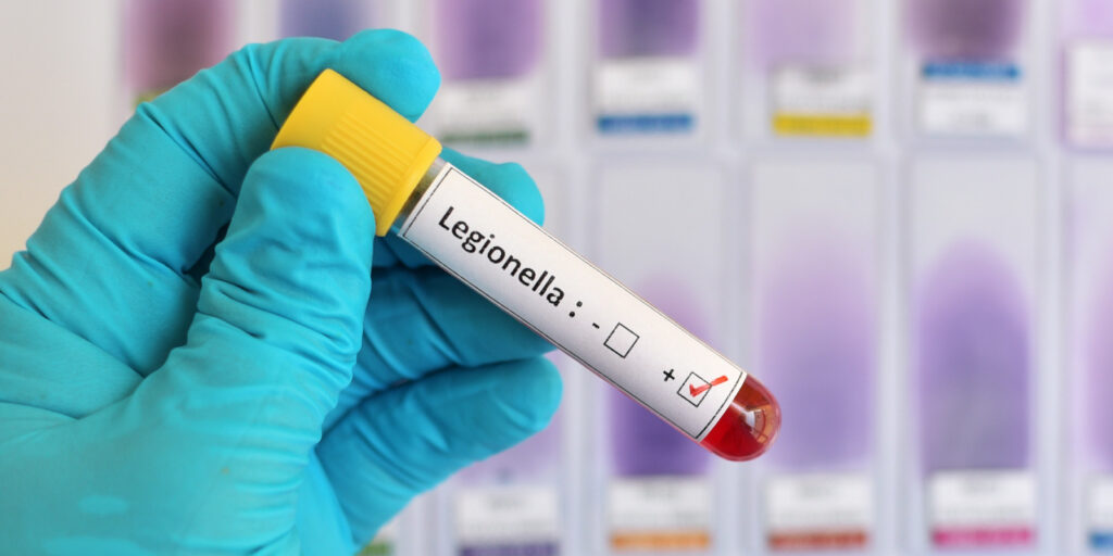 specimen in test tube tests positive for legionella