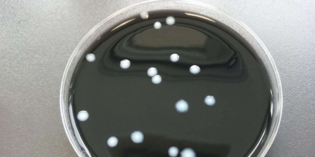 bacteruim legionella sp growth on petri dish