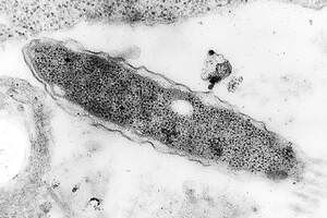 single legionella bacteria