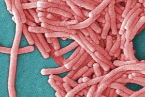 legionella bacteria under microscope after a legionella outbreak