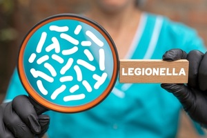 concept of legionella test