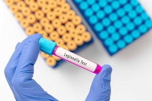 legionella test result with blood sample in test tube on doctor hand in medical lab