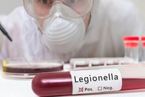man testing legionella in blood sample