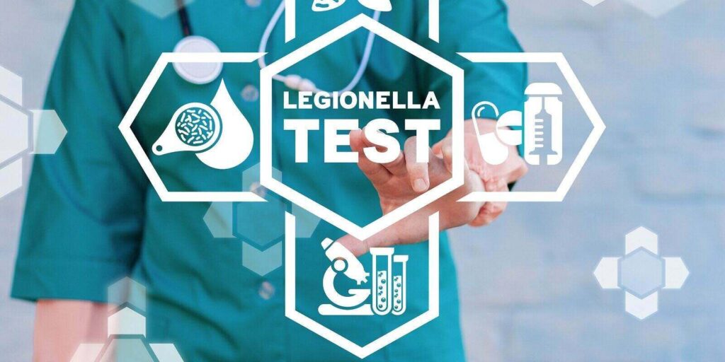 medical concept of legionella test